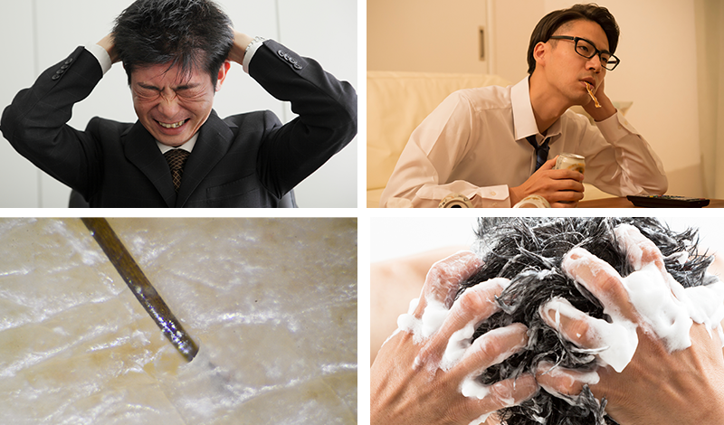ストレスを抱える男性、飲酒する男性、頭皮のアップ、爪を立ててシャンプーする男性