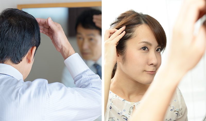 生え際を気にする男性と女性