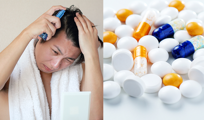 育毛剤を使用する男性、薬やサプリメント