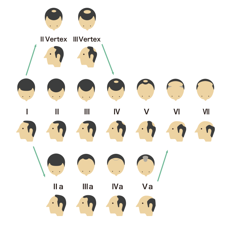 ハミルトン・ノーウッド分類