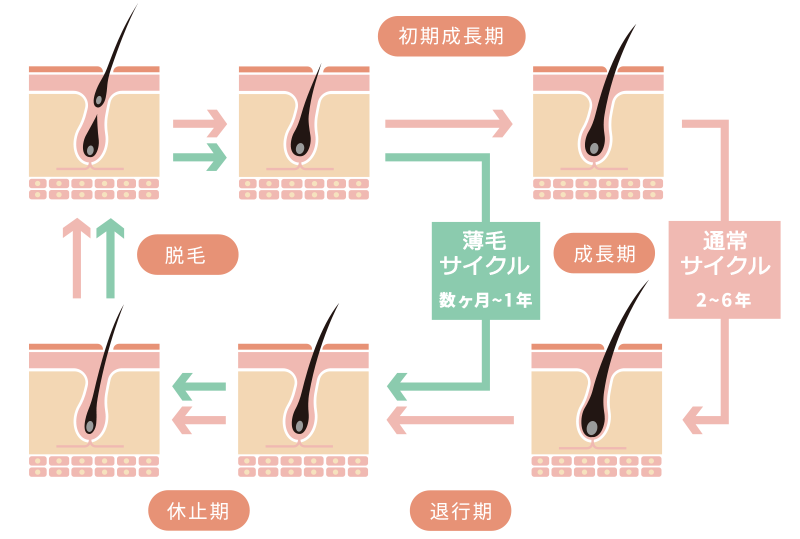 髪の毛の通常サイクルと薄毛サイクル