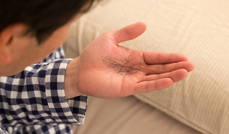 抜け毛を手に持つ男性