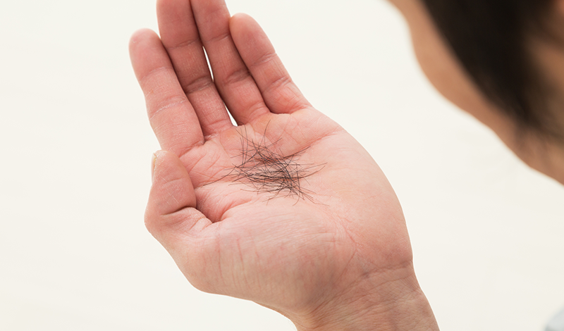 抜けた髪の毛を手に持つ