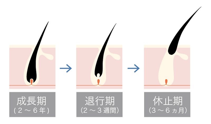 髪の毛の成長サイクル、成長期、退行期、休止期