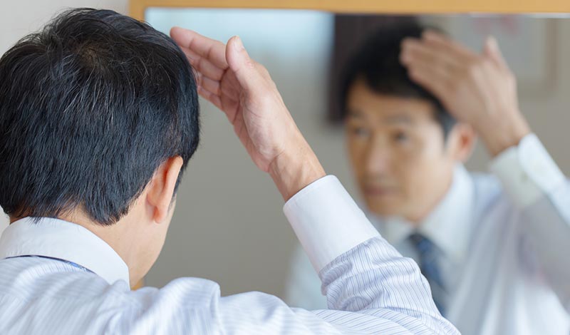 透けて見え始めた頭皮