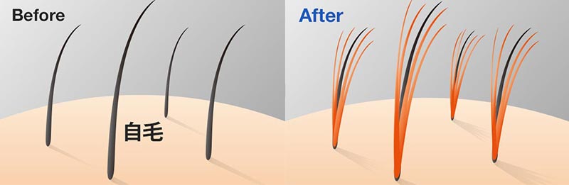 結毛式の増髪のイラスト