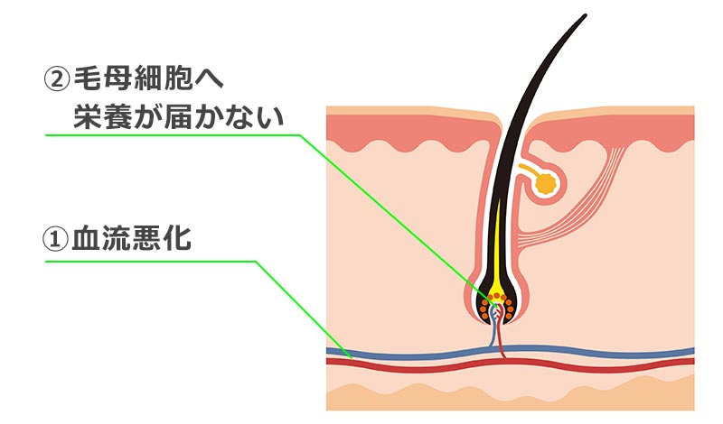 ①血流悪化　②毛母細胞へ栄養が届かない