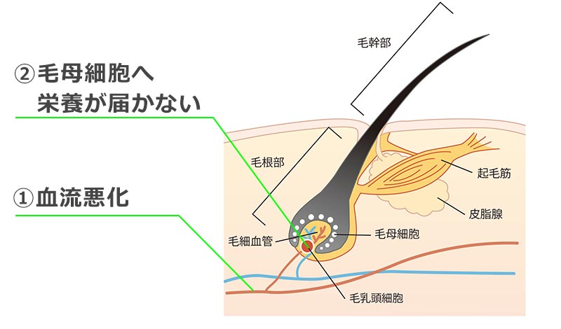 ストレスが頭皮の血管を収縮させ 薄毛の原因に 髪コト 頭髪を通じてライフスタイルを豊かにするための情報を発信