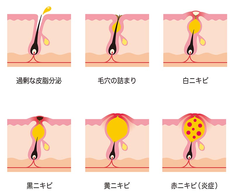 頭皮や髪の毛がべとつく 脂性の原因とは 髪コト 頭髪を通じてライフスタイルを豊かにするための情報を発信