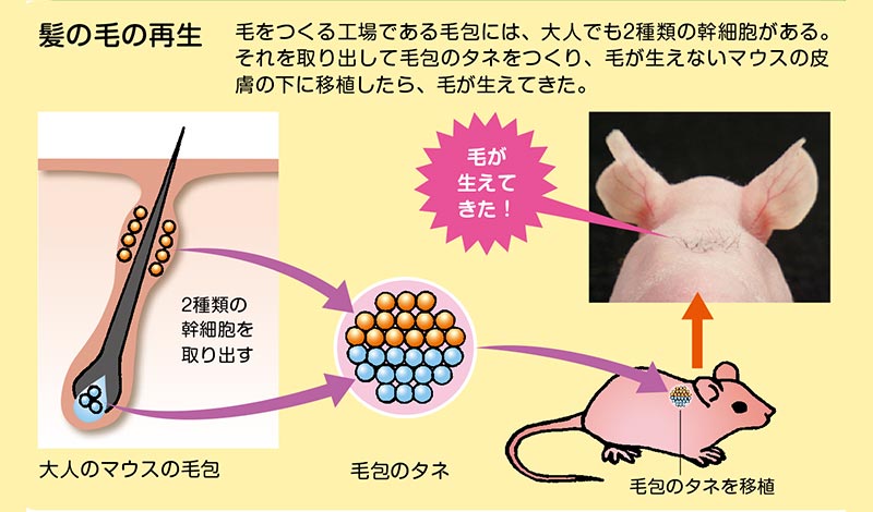 2021年版 実はこんなにあった薄毛の対策法 最新の手法も紹介 髪コト 頭髪を通じてライフスタイルを豊かにするための情報を発信