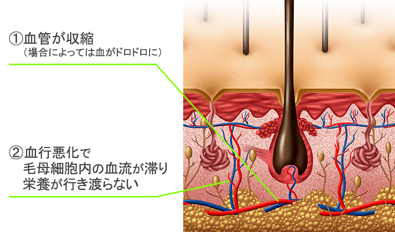 毛根のイメージ