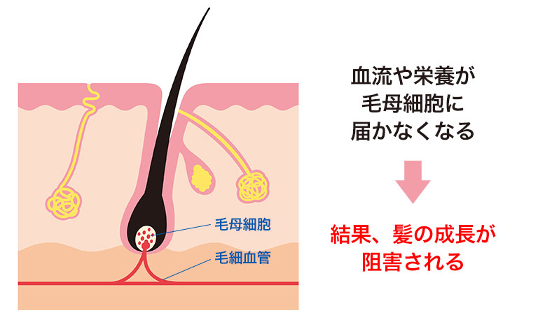 髪が頭のツボで甦った 薄毛に効く頭のツボ 8選 | 大阪の薄毛なら薄毛・抜け毛専門の