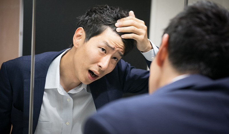 薄毛を気にする若いビジネスマン