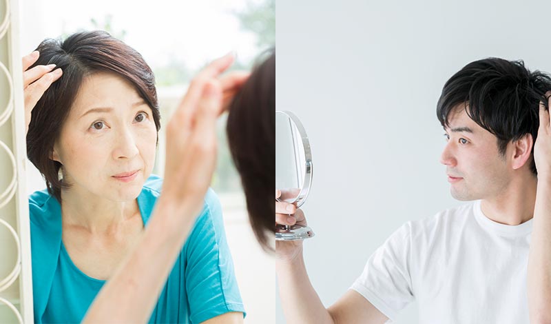 抜け毛を気にする男女