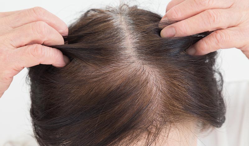 女性も不安 代女性 60代以上の年齢 年代別髪の毛に関する悩みの傾向と対策 髪コト 頭髪を通じてライフスタイルを豊かにするための情報を発信