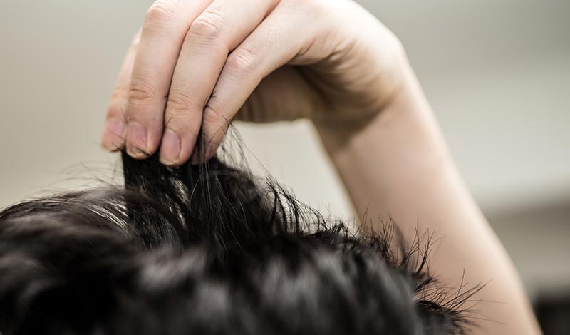 薄毛の気になり始め