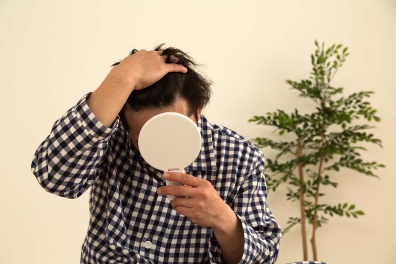 自分の生え際を気にする男性