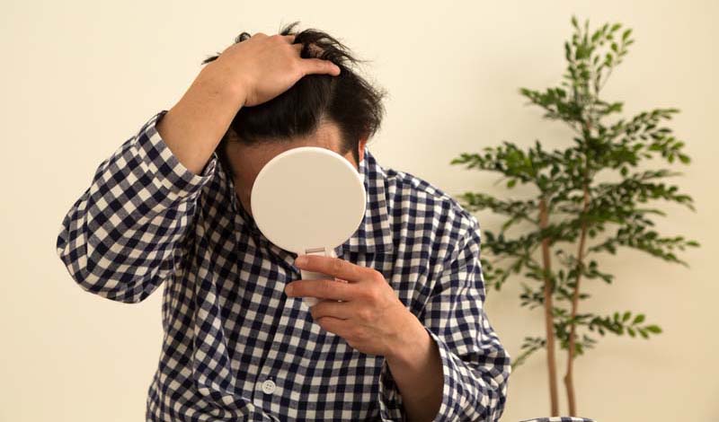 鏡で自分の生え際を確認する