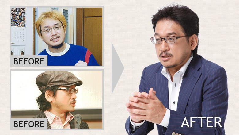 積極カミングアウトに薄毛の“送別会”…　型破りなやくみつる的増毛論を実践した！