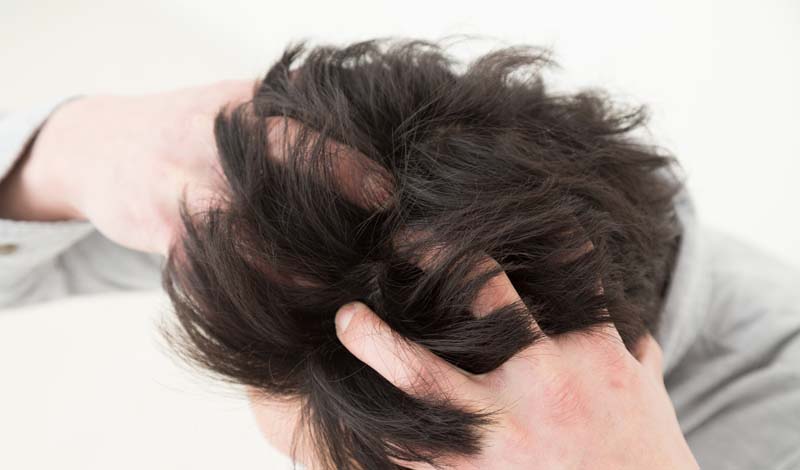 薄毛に悩む男性