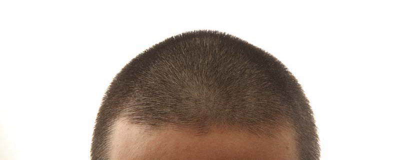薄毛 はげ の人が坊主にする時に気をつけたいこと 似合わない理由を徹底調査 髪コト 頭髪を通じてライフスタイルを豊かにするための情報を発信