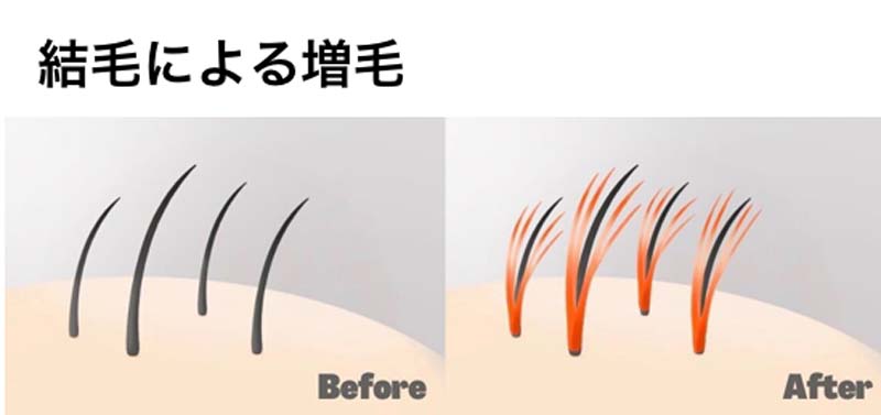 結毛による増毛 イメージイラスト