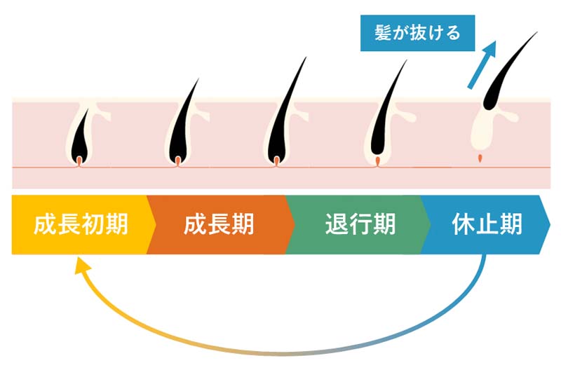 一日300本の抜け毛は正常？異常なケースや抜け毛が続くときの対処法 | 抜け毛・薄毛のお悩み