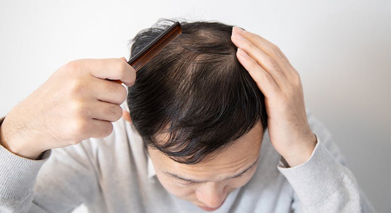 薄毛を隠せる髪形 ヘアセットを知りたい 男性用ファッションウィッグ かつら 増毛や薄毛対策のメンズスヴェンソン 薄毛を隠せる髪形 ヘアセットを知りたい 男性用ファッションウィッグ かつら 増毛や薄毛対策のメンズスヴェンソン