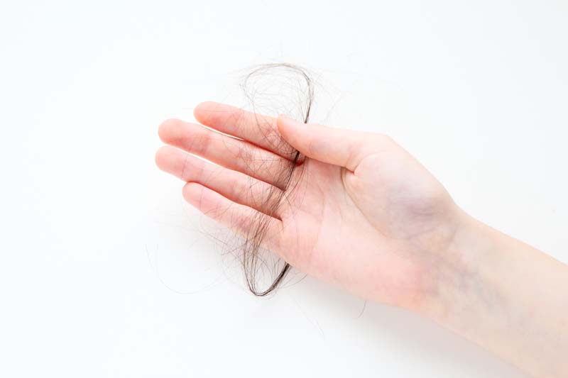 多量の抜け毛を手で持っている様子