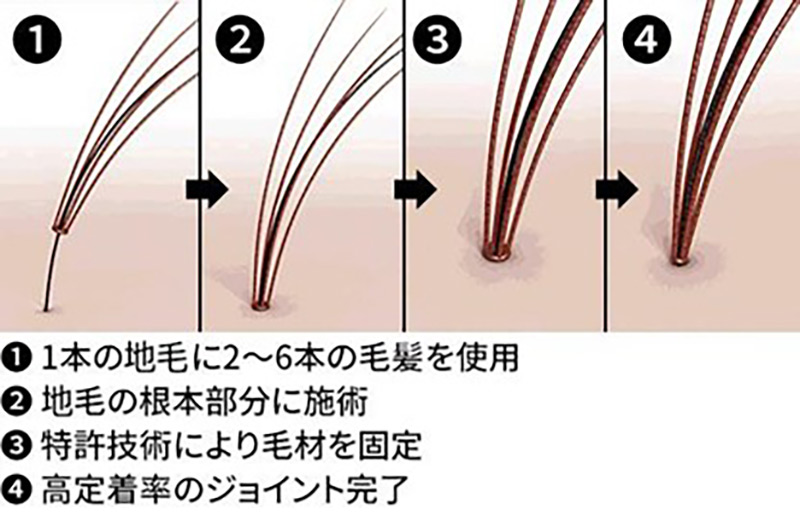 ストレスと抜け毛は関係ない のウソホント 髪コト 頭髪を通じてライフスタイルを豊かにするための情報を発信
