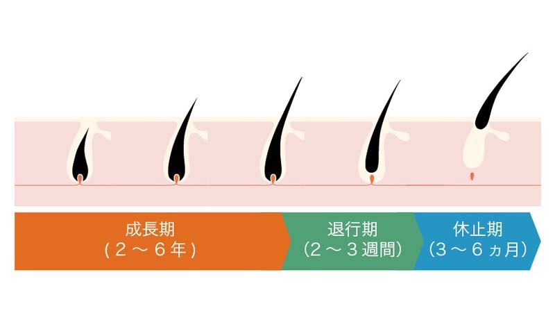 bellさま専用】髪の毛、頭皮、AGA等、髪のお悩み全般に。髪の毛ブレス