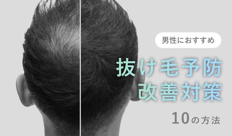 【薄毛対策】男性におすすめの髪の抜け毛予防&防止対策を解説