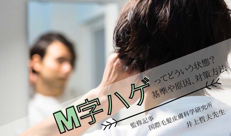 監修記事 M字ハゲってどういう状態のこと 原因や対処法を解説 髪コト 頭髪を通じてライフスタイルを豊かにするための情報を発信 監修記事 M字ハゲってどういう状態のこと 原因や対処法を解説 髪コト 頭髪を通じてライフスタイルを豊かにするための情報を発信