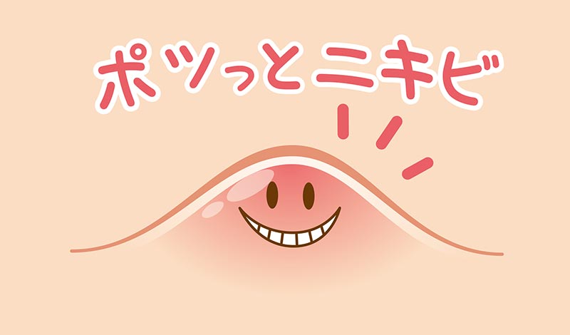つらい頭皮ニキビの対策方法は？