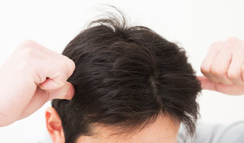 抜け毛を予防するためのケア方法