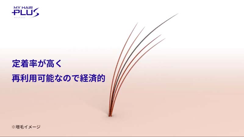 スヴェンソンの増毛（結毛）「マイヘアプラス」のイメージイラスト。定着率が高く、再利用が可能なので経済的。