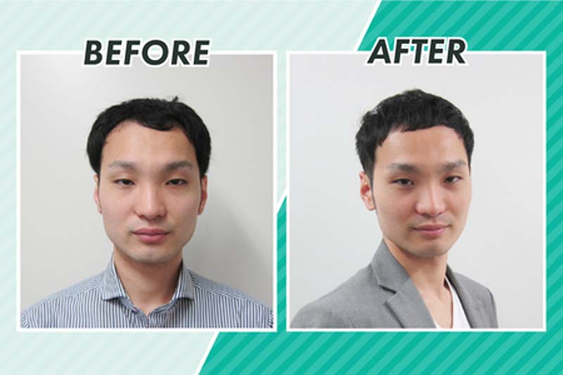 スヴェンソンのヘアカットによるビフォーアフター写真1(正面)