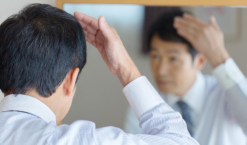 頭皮が透けて見えてきたと感じたらとるべき行動 髪コト 頭髪を通じてライフスタイルを豊かにするための情報を発信 頭皮が透けて見えてきたと感じたらとるべき行動 髪コト 頭髪を通じてライフスタイルを豊かにするための情報を発信