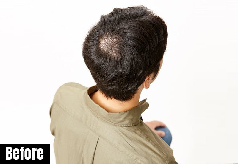 デザインカット エアリー系ナチュラルパーマ 男性用ファッションウィッグ かつら 増毛や薄毛対策のメンズスヴェンソン デザインカット エアリー系ナチュラルパーマ 男性用ファッションウィッグ かつら 増毛や薄毛対策のメンズスヴェンソン