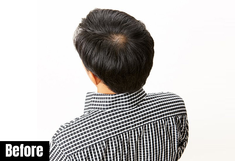 デザインカット-大人なセクシー・ショートスタイル