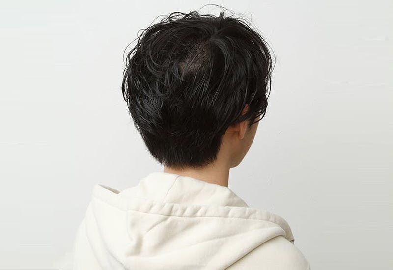 デザインカット クラウドマッシュ ゆるカジモード系 男性用ファッションウィッグ かつら 増毛や薄毛対策のメンズスヴェンソン デザインカット クラウドマッシュ ゆるカジモード系 男性用ファッションウィッグ かつら 増毛や薄毛対策のメンズスヴェンソン