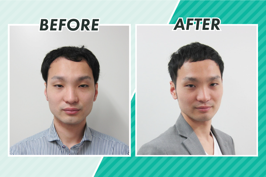 スヴェンソンの「デザインカット」による薄毛のビフォーアフター写真1（正面）
