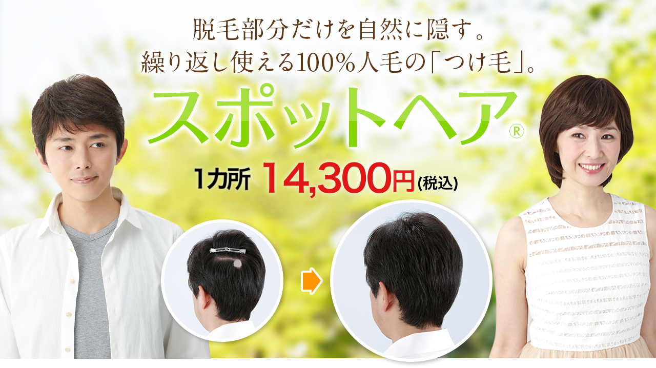 スヴェンソン「スポットヘア」のバナー　1カ所14,300円（税込）