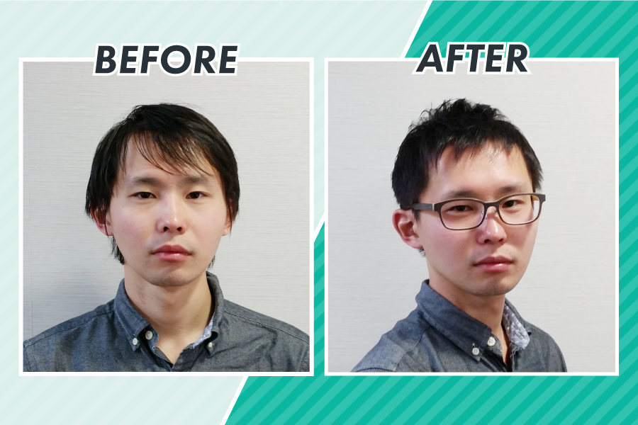 スヴェンソンの「デザインカット」による薄毛のビフォーアフター写真2（正面）