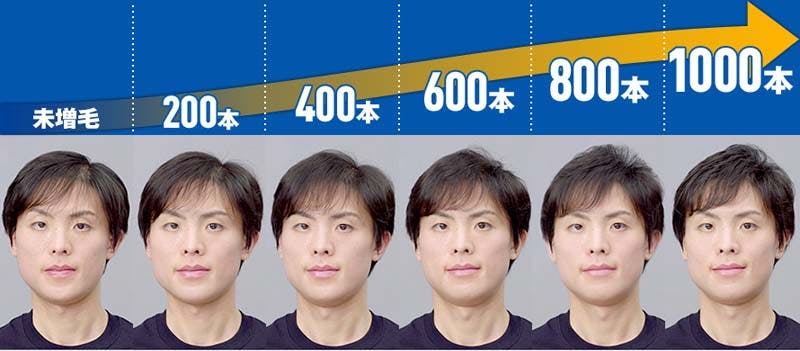 200本ごとの見た目の変化（正面）