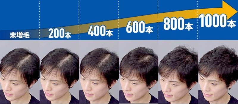 200本ごとの見た目の変化（分け目）