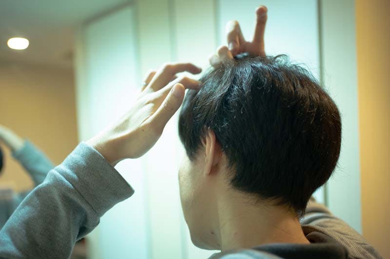 髪のボリュームを気にする男性画像