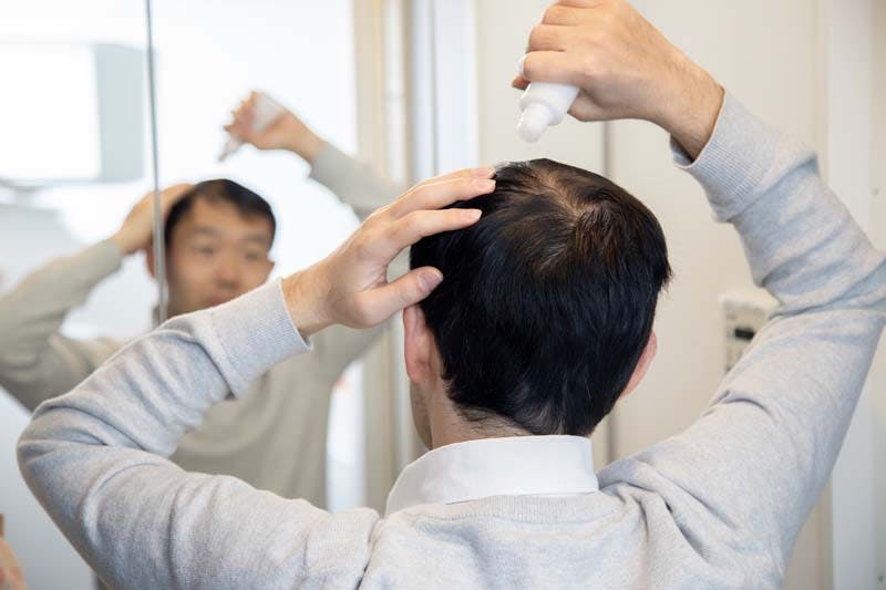 男性が薄毛のセルフケアをしている様子