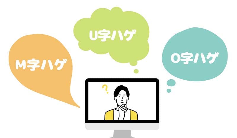 男性が自身の薄毛タイプについて考えているイラスト