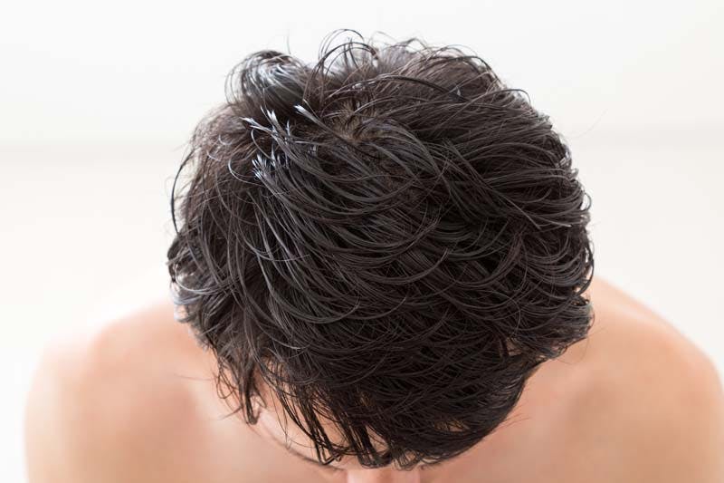 男性の毛髪が増量するイメージ画像